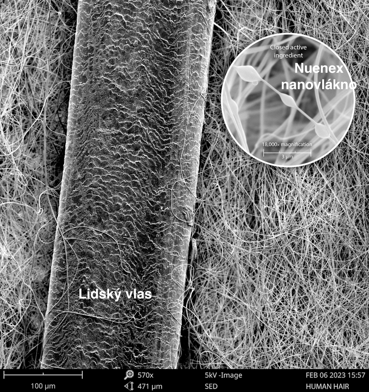 neunex-respilon neunex-respilon